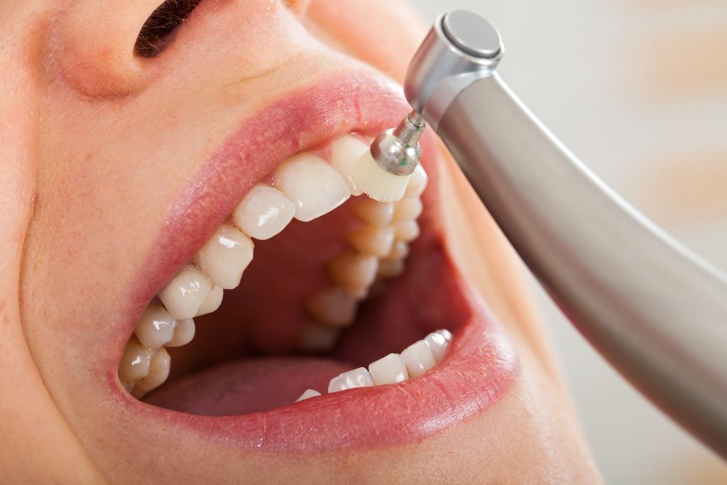 Dentist in North Palm Beach, Dentist in Palm Beach Gardens, Dentist in Juno Ridge, Dentist in Jupiter, Dentist West Palm Beach, Dentist in Lake Park, Dentist in Riviera Beach, Dentist in Cabana Colony, Dental Implant in North Palm Beach, Dental Implants in Palm Beach Gardens, Dental Implants in Riviera Beach, Dental Implants West Palm Beach, Emergency Dentist North Palm Beach, Emergency Dentist in West Palm Beach, Emergency Dentist in Palm Beach Gardens, PROFESSIONAL TEETH CLEANING